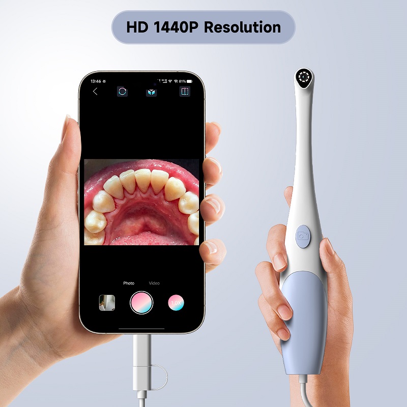 Caméra endoscopique orale 1440 - Photography Lighting Description avis et prix